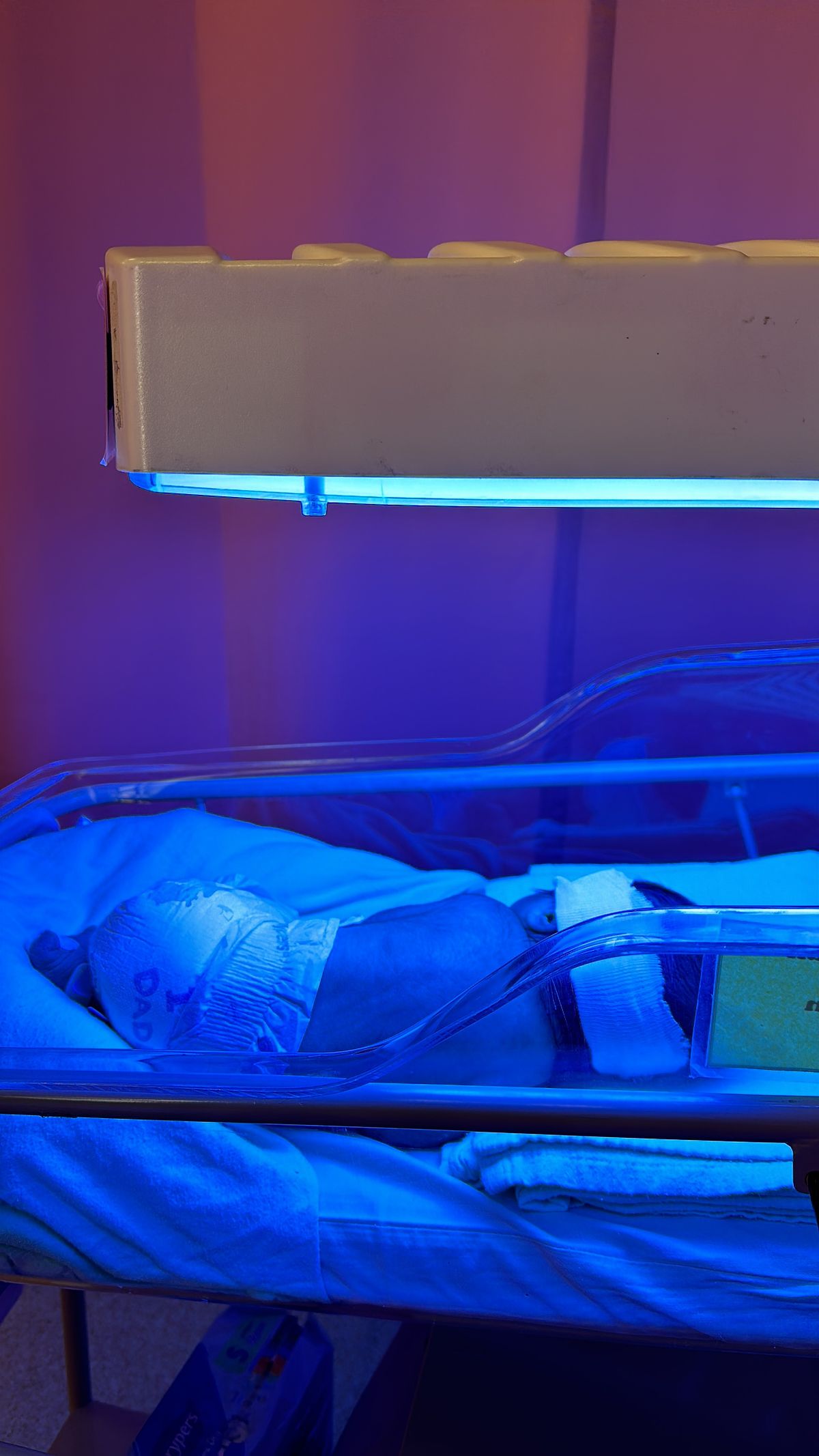 A newborn baby receiving phototherapy treatment in an incubator under blue light